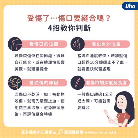 受傷縫針可以喝酒嗎|急診—外傷縫合後注意事項 